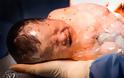 Φωτογραφίες-σοκ: Μωρό γεννήθηκε μέσα στον αμνιακό σάκο - Φωτογραφία 6