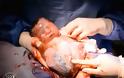 Φωτογραφίες-σοκ: Μωρό γεννήθηκε μέσα στον αμνιακό σάκο - Φωτογραφία 8