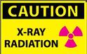 Πόσο επικίνδυνη είναι η ακτινοβολία από τις ιατρικές εξετάσεις; Τι επιτρέπεται για τις εγκύους και τα παιδιά;