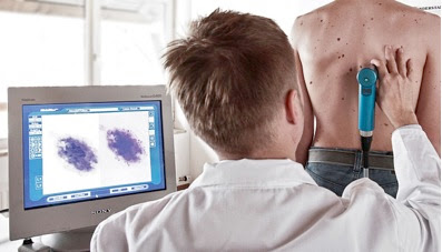 Τι είναι η ψηφιακή χαρτογράφηση σπίλων, για τις ελιές του δέρματος, τον καρκίνο, το μελάνωμα - Φωτογραφία 2