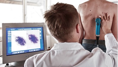 Τι είναι η ψηφιακή χαρτογράφηση σπίλων, για τις ελιές του δέρματος, τον καρκίνο, το μελάνωμα - Φωτογραφία 7