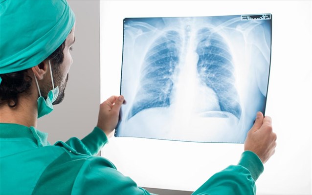 Πνεύμονας: Δεν είναι όλα τα ιατρικά ευρήματα καρκίνος - Φωτογραφία 1