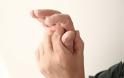 Ποιες είναι οι πιο συχνές αιτίες για τον πόνο στα χέρια; - Φωτογραφία 1