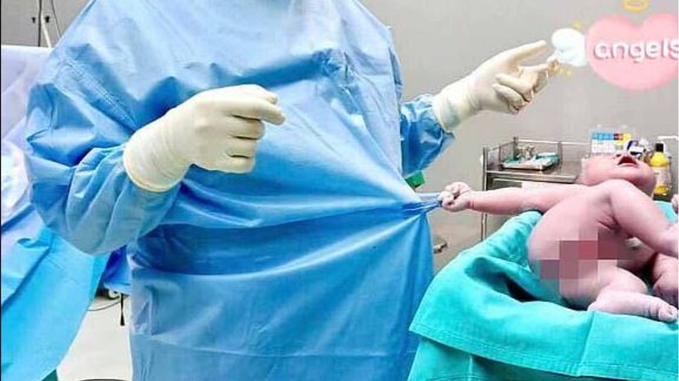 Δείτε τη viral φωτογραφία του «ζόρικου» νεογέννητου που... δεν αφήνει τον γιατρό να φύγει - Φωτογραφία 1