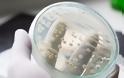 Candida Auris: Ο πολυανθεκτικός μύκητας από τις ΗΠΑ που εξελίχθηκε σε ενδονοσοκομειακή απειλή για όλες τις χώρες