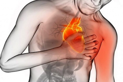 Ένα μήνα πριν από μια καρδιακή προσβολή το σώμα σας θα σας προειδοποιήσει με αυτά τα 6 σημάδια - Φωτογραφία 1