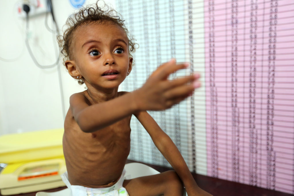 Υεμένη: Χιλιάδες παιδιά πεθαίνουν, αλλά δεν είναι δικά μας - Φωτογραφία 1