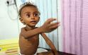 Υεμένη: Χιλιάδες παιδιά πεθαίνουν, αλλά δεν είναι δικά μας