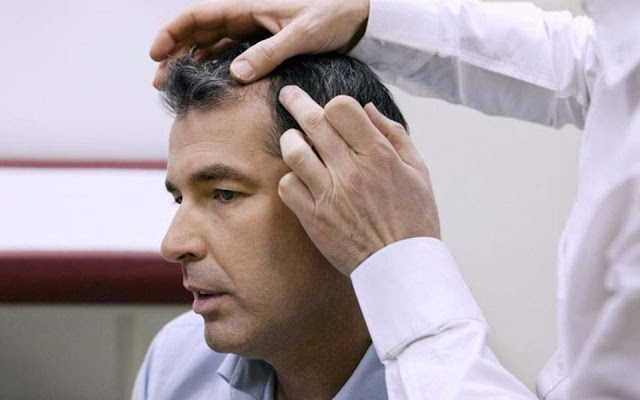 Οι δερματολόγοι κρούουν τον κώδωνα του κινδύνου για τις μεταμοσχεύσεις μαλλιών χαμηλού κόστους - Φωτογραφία 1