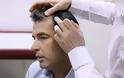 Οι δερματολόγοι κρούουν τον κώδωνα του κινδύνου για τις μεταμοσχεύσεις μαλλιών χαμηλού κόστους - Φωτογραφία 1