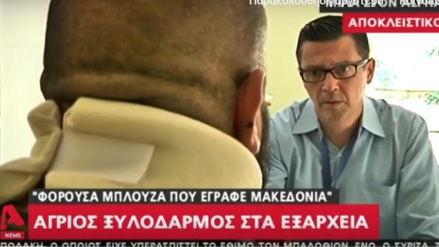 Βίντεο: Με κατάγματα και σχεδόν χωρίς αυτί ο 45χρονος που ξυλοκόπησαν στα Εξάρχεια,γιατί φορούσε μπλούζα «Macedonian Warriors» - Φωτογραφία 1