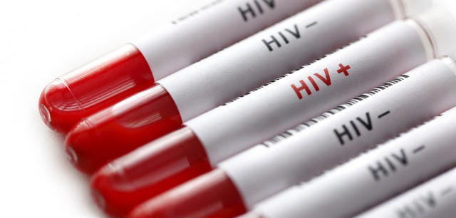 Την εξάλειψη της μάστιγας του AIDS υπόσχονται τα ευρήματα επιστημόνων! - Φωτογραφία 1