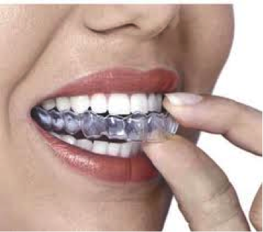 Γιατί χάνεται ένα δόντι; Απώλεια δοντιού, αιτία, συνέπειες, πρόληψη, αντιμετώπιση - Φωτογραφία 10