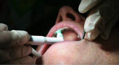 Γιατί χάνεται ένα δόντι; Απώλεια δοντιού, αιτία, συνέπειες, πρόληψη, αντιμετώπιση - Φωτογραφία 9
