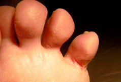 18 προβλήματα των ποδιών μας που μας προειδοποιούν για τη συνολική μας υγεία - Φωτογραφία 13
