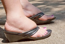 18 προβλήματα των ποδιών μας που μας προειδοποιούν για τη συνολική μας υγεία - Φωτογραφία 8