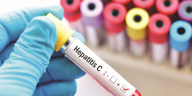 Πώς δεν μεταδίδεται η ηπατίτιδα C; Δείτε 10 περιπτώσεις - Φωτογραφία 1