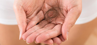 Αιτίες τριχόπτωσης. Τι να τρώτε για υγιέστερα μαλλιά - Φωτογραφία 3