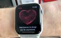 Apple Watch: Επιβεβαιώθηκε από την Apple η ιαθεσιμότητα του ηλεκτροκαρδιογραφήματος (ΗΚΓ) στον Καναδά