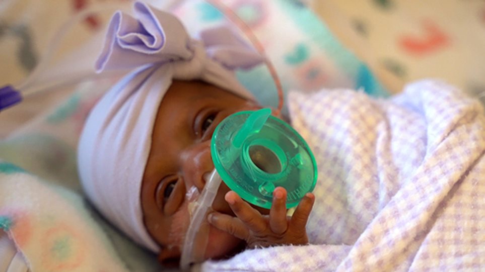 Το θαύμα της ζωής: Κοριτσάκι γεννήθηκε 245 γραμμάρια αλλά κέρδισε τη μάχη μετά από πέντε μήνες - Φωτογραφία 1