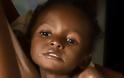 Από πείνα οι μισοί θάνατοι παιδιών στην Αφρική