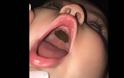 Είδε αυτό το σημάδι στο στόμα του μωρού της και πανικοβλήθηκε