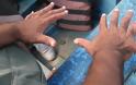 Εξαδάκτυλοι: Πώς λειτουργεί ο εγκέφαλος των ανθρώπων με ένα επιπλέον δάκτυλο σε κάθε χέρι