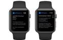 Apple Watch: ενημερώσεις από το ρολόι έρχονται άμεσα