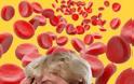 Βρέθηκε χαμηλός αιματοκρίτης; Ποιες οι αιτίες της αναιμίας εκτός από καρκίνο; - Φωτογραφία 3