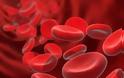 Βρέθηκε χαμηλός αιματοκρίτης; Ποιες οι αιτίες της αναιμίας εκτός από καρκίνο; - Φωτογραφία 5