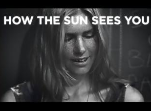Δείτε αυτό το βίντεο και ίσως... δεν ξαναβγείτε ποτέ στον ήλιο χωρίς αντηλιακό - Φωτογραφία 1