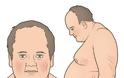 Σύνδρομο Cushing, με αύξηση βάρους, εύκολη κόπωση, υπέρταση, διαβήτη, αγχώδεις διαταραχές