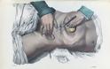 Πώς γίνονταν οι χειρουργικές επεμβάσεις το 1840 - ΣΥΓΚΛΟΝΙΣΤΙΚΕΣ εικόνες από χειρουργεία ΧΩΡΙΣ ΑΝΑΙΣΘΗΤΙΚΟ... [photos] - Φωτογραφία 10