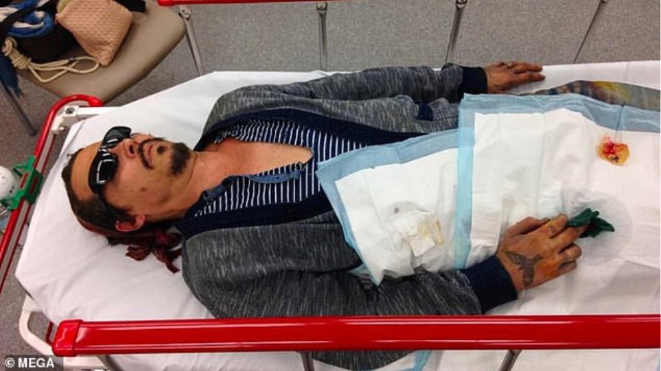 Ο Τζόνι Ντεπ αιμόφυρτος και καμμένος στο νοσοκομείο μετά από καβγά με την Αμπερ Χερντ - Φωτογραφία 1