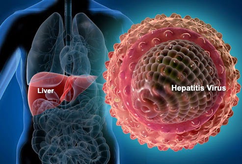 Τι προκαλεί η ιογενής Ηπατίτιδα; Πώς μεταδίδεται, πώς αντιμετωπίζεται και ποια ηπατίτιδα θεραπεύεται πλήρως; - Φωτογραφία 4