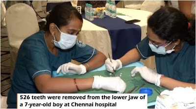 Απίστευτο: Αφαίρεσαν από 7χρονο παιδί 526 δόντια - Φωτογραφία 1