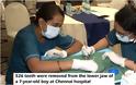 Απίστευτο: Αφαίρεσαν από 7χρονο παιδί 526 δόντια