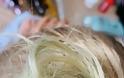 Καταγγελία Βρετανών: Πρασίνισαν τα μαλλιά τους μετά από βουτιά σε πισίνα πεντάστερου στην Κω - Φωτογραφία 2
