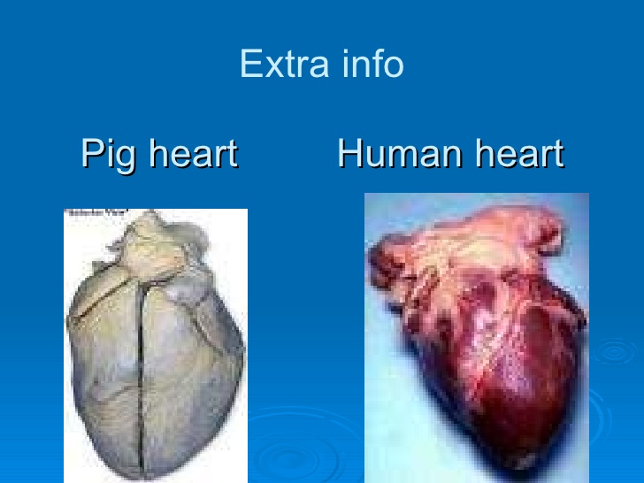 Η μεταμόσχευση καρδιάς χοίρου σε καρδιά ανθρώπου θα είναι δυνατή εντός τριετίας - Φωτογραφία 1