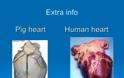 Η μεταμόσχευση καρδιάς χοίρου σε καρδιά ανθρώπου θα είναι δυνατή εντός τριετίας