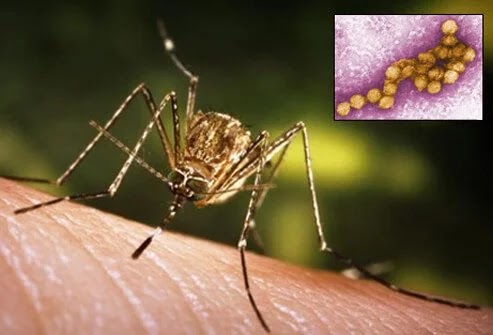 Συμπτώματα της λοίμωξης από ιό του Δυτικού Νείλου, που μεταδίδεται με τα κουνούπια; - Φωτογραφία 2