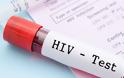 AIDS: Γενετική μετάλλαξη δημιουργεί «φυσική ανοσία» στον ιό HIV