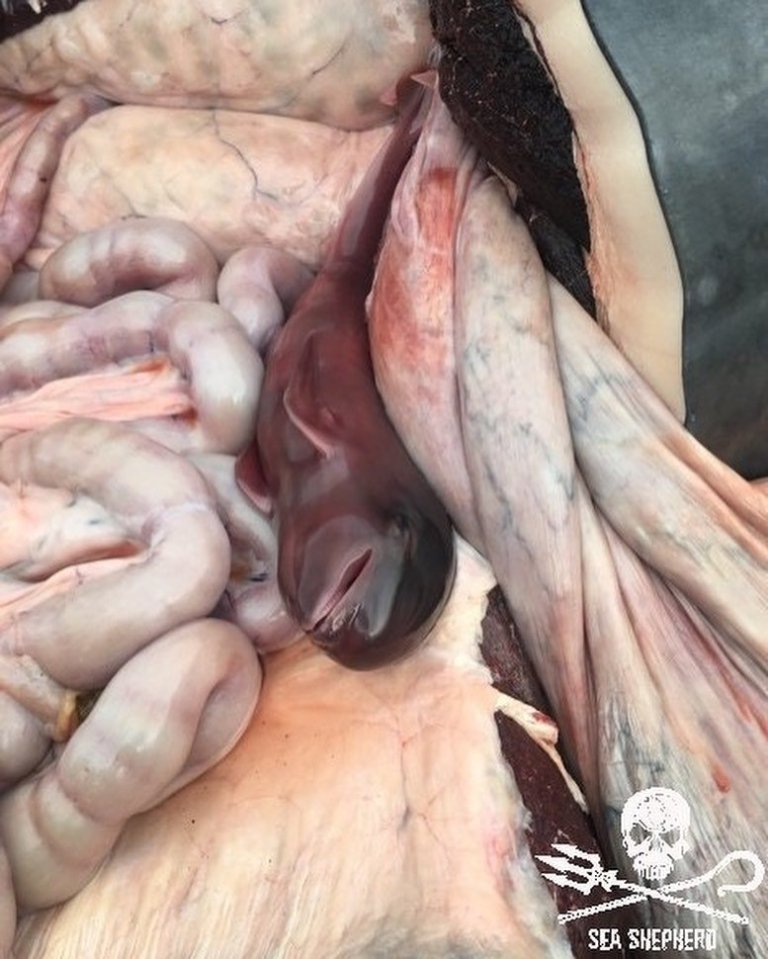 Φρίκη: Αγέννητα μικρά απομακρύνονται από τις κοιλιές δεκάδων φαλαινών που σφαγιάστηκαν! (pics & vid) - Φωτογραφία 4