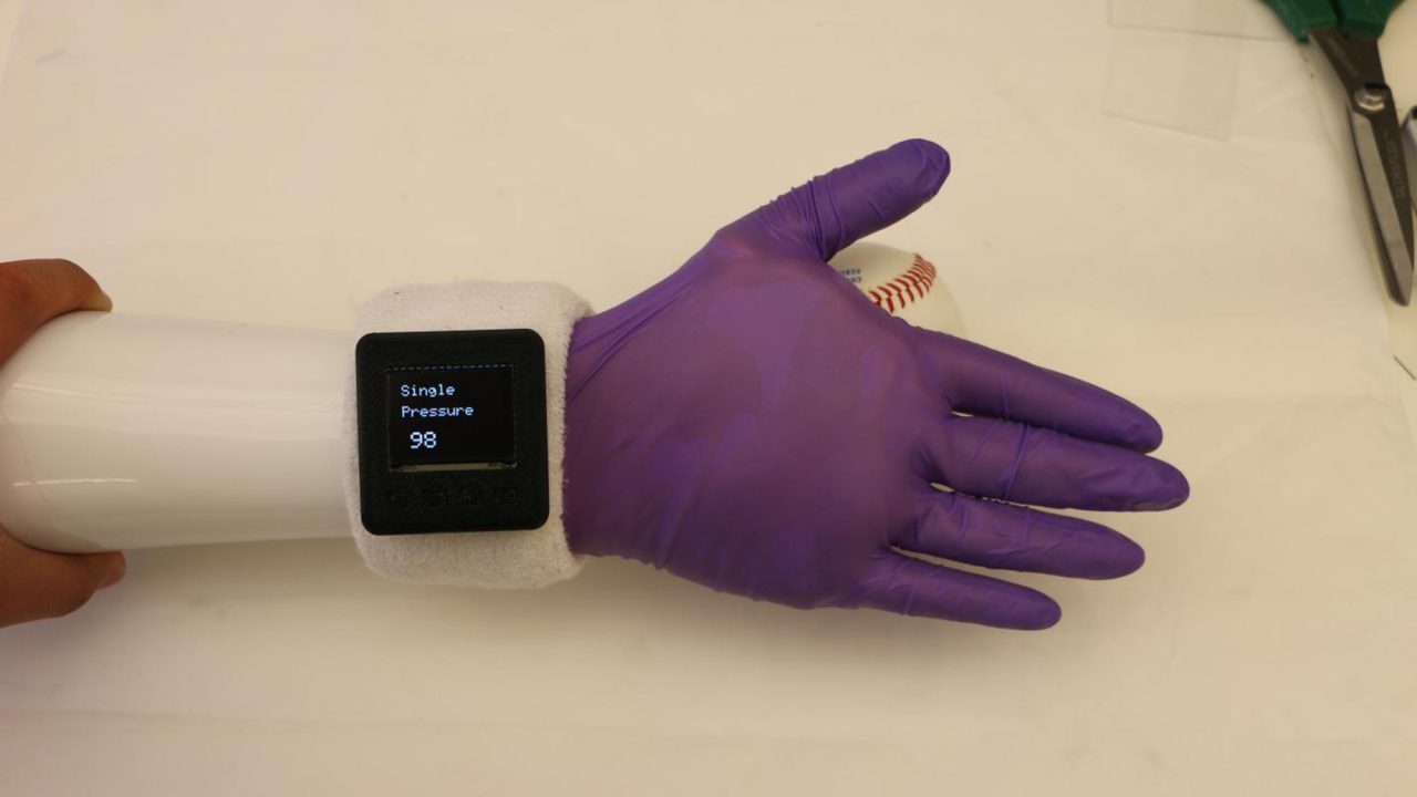 Ηλεκτρονικό γάντι προσφέρει φυσική αίσθηση σε πρόσθετο χέρι - Φωτογραφία 1