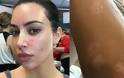Η Κιμ Καρντάσιαν αφαιρεί το make up και δείχνει τα σημάδια της ψωριασικής αρθρίτιδας πάνω της - Φωτογραφία 1