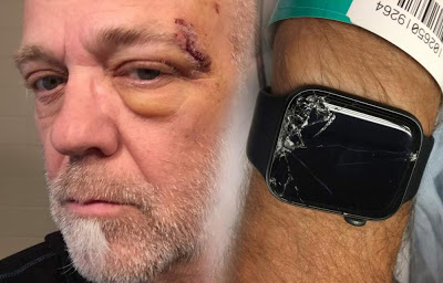 Ο αισθητήρας πτώσης του Apple Watch του έσωσε τη ζωή - Φωτογραφία 1
