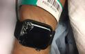 Ο αισθητήρας πτώσης του Apple Watch του έσωσε τη ζωή - Φωτογραφία 3