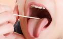 Έρευνα για την πρόγνωση μεταστάσεων του ακανθοκυτταρικού καρκίνου του στόματος
