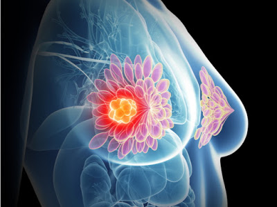 Η σημασία της έγκαιρης διάγνωσης στον καρκίνο του μαστού. Εγκυμοσύνη και θηλασμός μετά από μαστεκτομή - Φωτογραφία 1