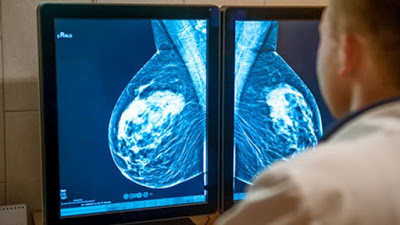 Η σημασία της έγκαιρης διάγνωσης στον καρκίνο του μαστού. Εγκυμοσύνη και θηλασμός μετά από μαστεκτομή - Φωτογραφία 3
